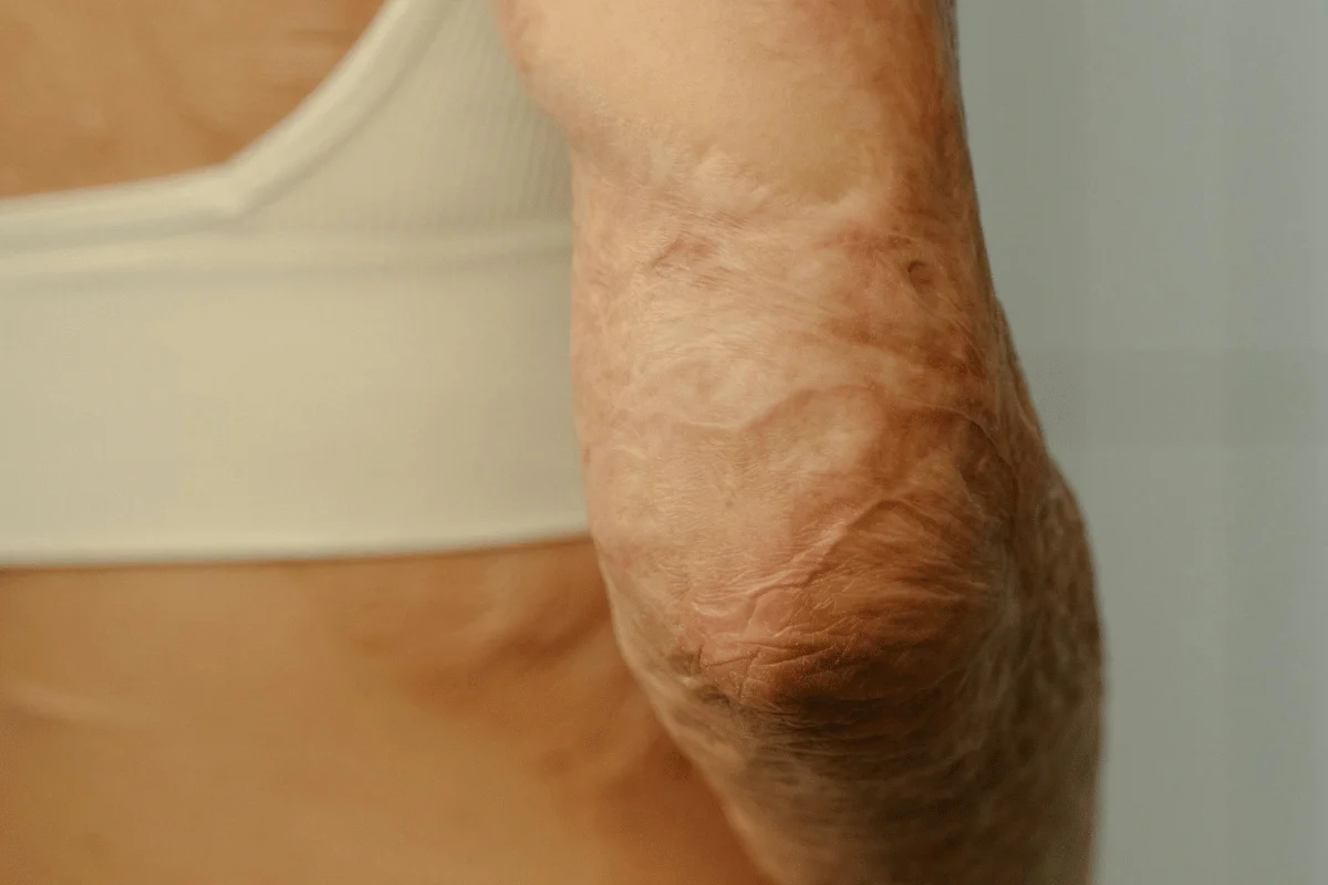 Close-up of a wrinkled elbow with aged skin texture.