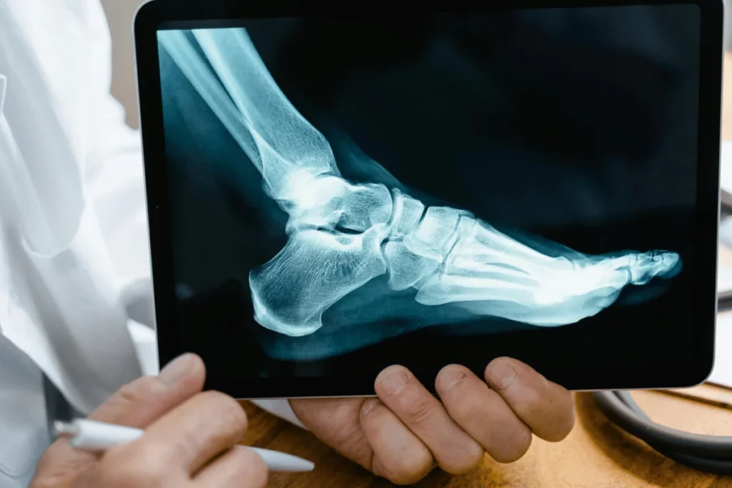 Doctor holding a tablet displaying a detailed X-ray of a foot.