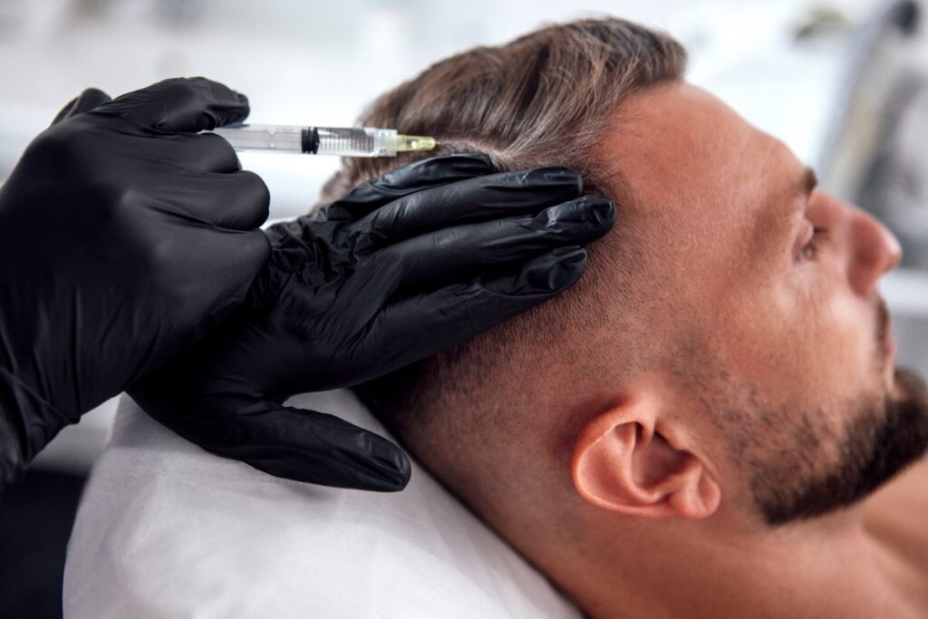 A man receiving peptide therapy for hair growth
